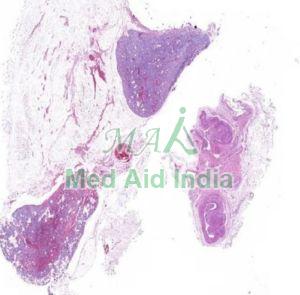 Histology Slide Parathyroid Gland