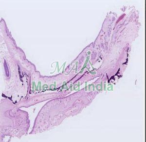 Oral Histology Hard Palate Fetal