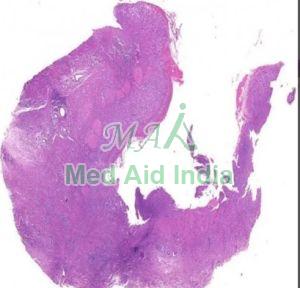 Plain Pathology Slides, Color : Transparent Standard For Clinical, Laboratory