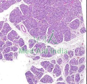 Salivary Gland Lesions Digital Slides Standard For Clinical, Laboratory