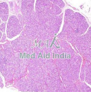 Salivary Gland Of Tumors Digital Slide Sets