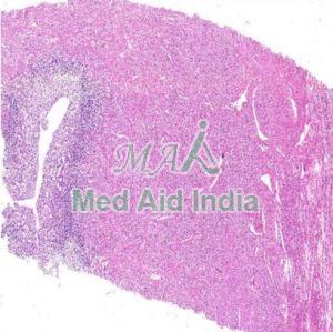 Secretory Endometrium Histology Slide