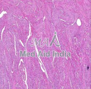 Smooth Muscle Anaomy Slide
