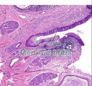 Taste Bud Oral Histology Prepared Slide