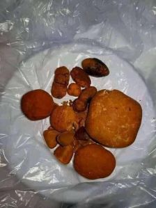 Ox Gallstone
