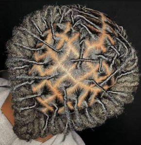 Dreadlocks Intention Treatment Service
