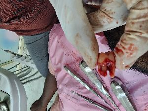 Advanced / Laser Dentistry