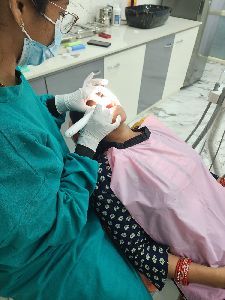 Pediatric Habit Counseling (Thumb Sucking / Pacifier Use)