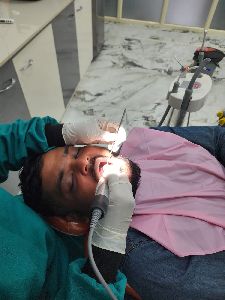 Smile Gap Closure / Diastema Correction