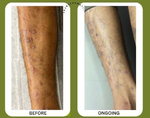 Medical Treatment Services