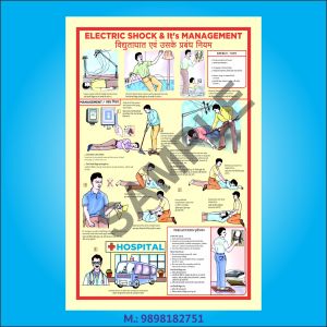 Electric Shock Treatment Charts