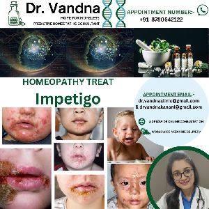 Online Homeopathy Consultation Services Impetigo Skin Problem