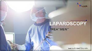 Laparoscopy Treatment
