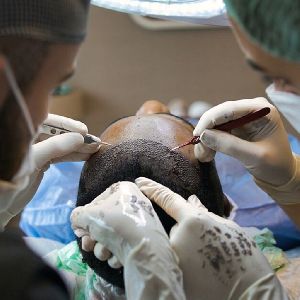 Hair Transplantation