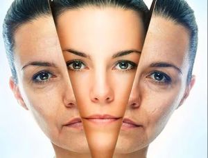 Laser Skin Treatment