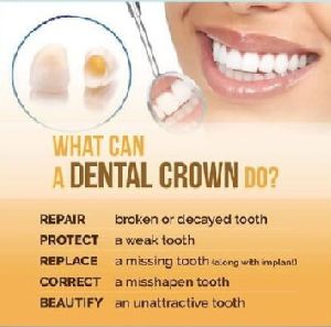 Root Canal Treatment