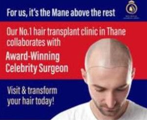 hair transplant service