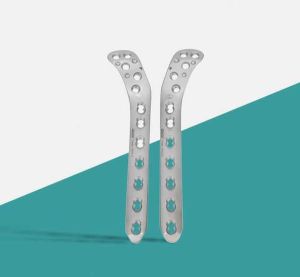 Lateral Tibial Locking Plate