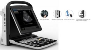 Chison Eco 3 Vet Portable Ultrasound System
