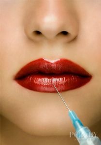 Hyaluronic Acid Filler