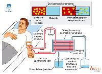 dialysis solutions