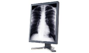 radiology monitors