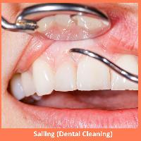 Salling Dental Cleaning