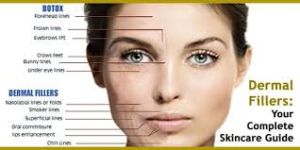 dermal fillers