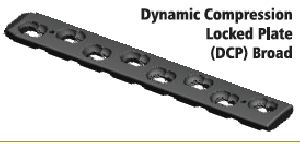 Dynamic Compression Lower Limb Plate