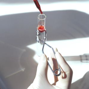 Vinyl Medical Gloves XL