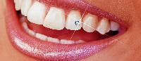 tooth jewellery