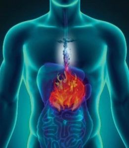 Acidity & Hyper Acidity Treatment Package Acidity & Hyper Acidity Treatment Package