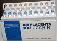 Lucchini Placenta