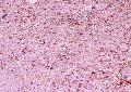 dehydrated pink onion granules
