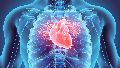 Stem Cell Therapy for Cardiovascular Disease