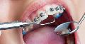 Orthodontics Treatment Services