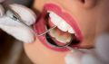 Endodontic Dental Treatment Services