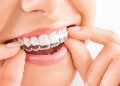 Orthodontic treatments and invisible braces
