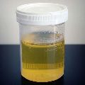 Dark-Yellow Liquid Distilled Cow Urine