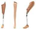 above knee prosthesis