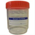 100ml Urine Containers