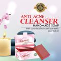 75gm Anti Acne Cleanser Soap